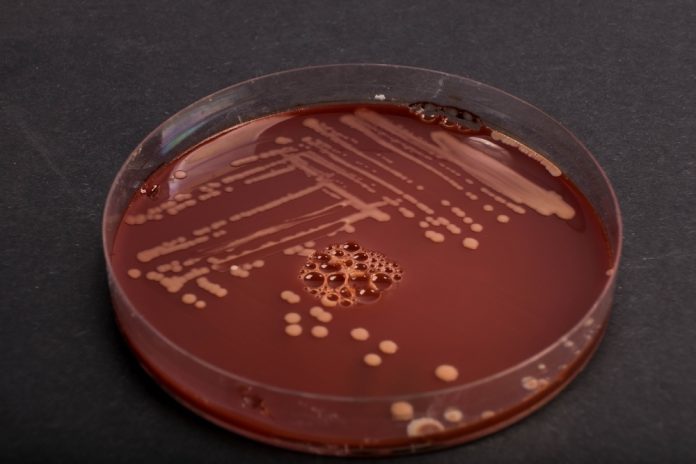 salmonella cioccolata